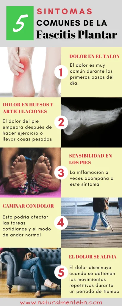 Fascitis plantar