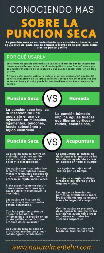Infograma de acupuntura o dry needling