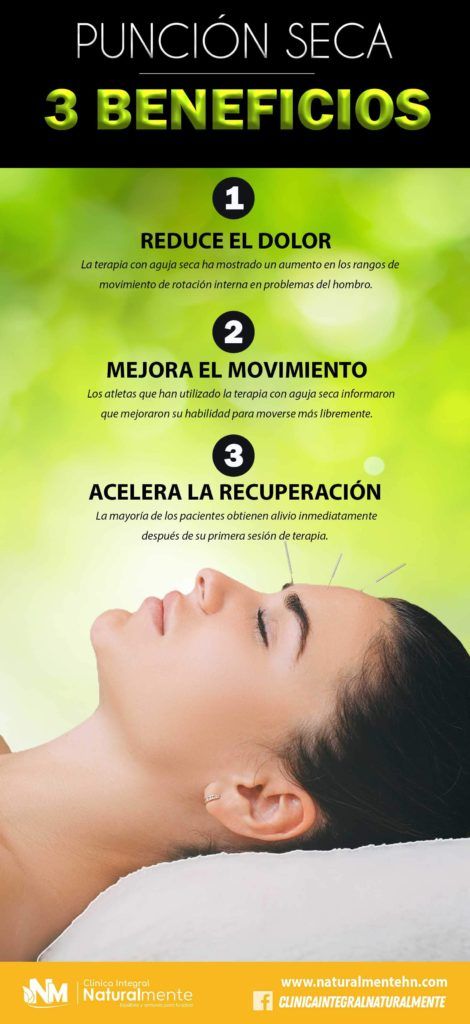 Infogracia de Punción Seca