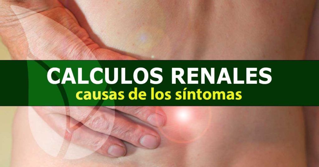 Cálculos-renales-causas-de-los-síntomas