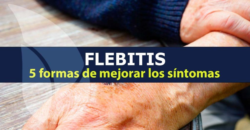Flebitis, 5 formas naturales de mejorar los síntomas