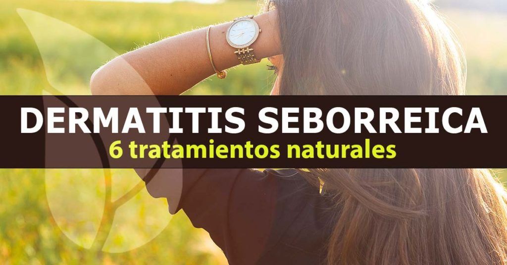 6 Tratamientos naturales para la dermatitis seborreica