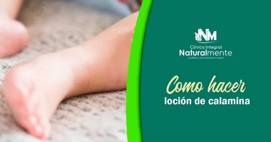 Cómo hacer loción de calamina natural